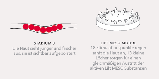 LiftMeso_001b